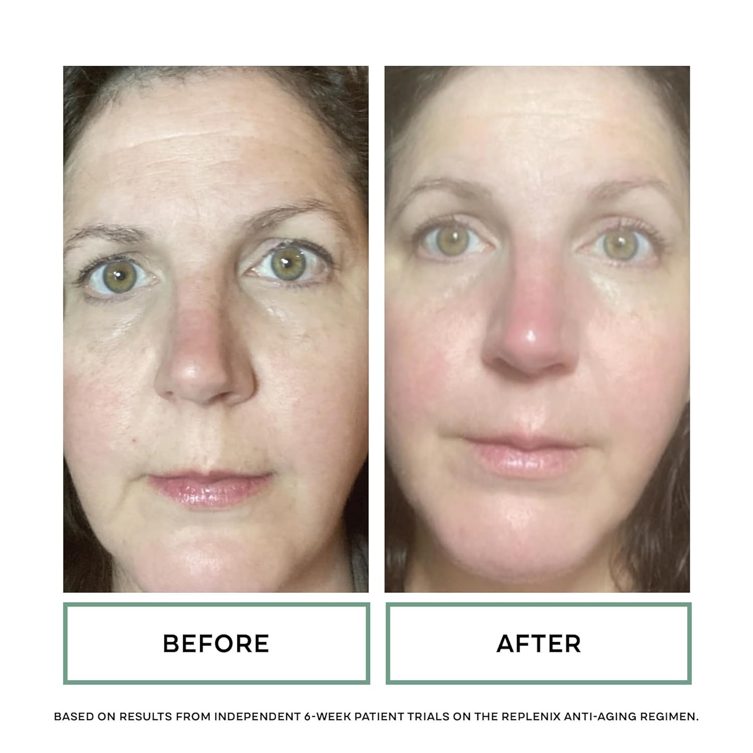 image:imageReplenix Age Restore AntiWrinkle Retinol Eye Repair MedicalGrade AntiAging Eye Cream for Fine Lines Dark Circles amp Puffiness 05 fl oz
