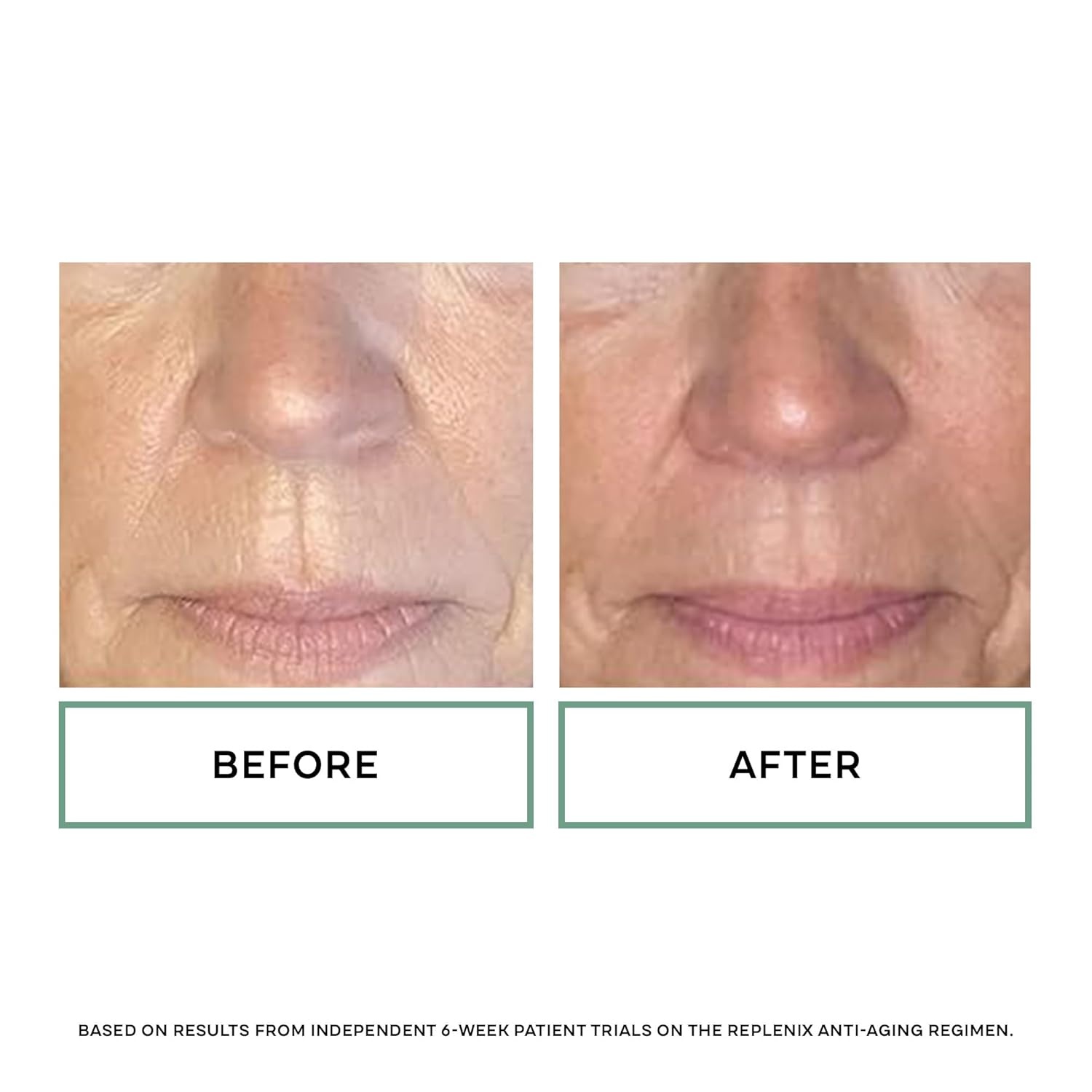 image:imageReplenix Age Restore Nighttime Therapy Face Cream AntiAging MedicalGrade Facial Moisturizer for Mature amp Dry SkinFull Size