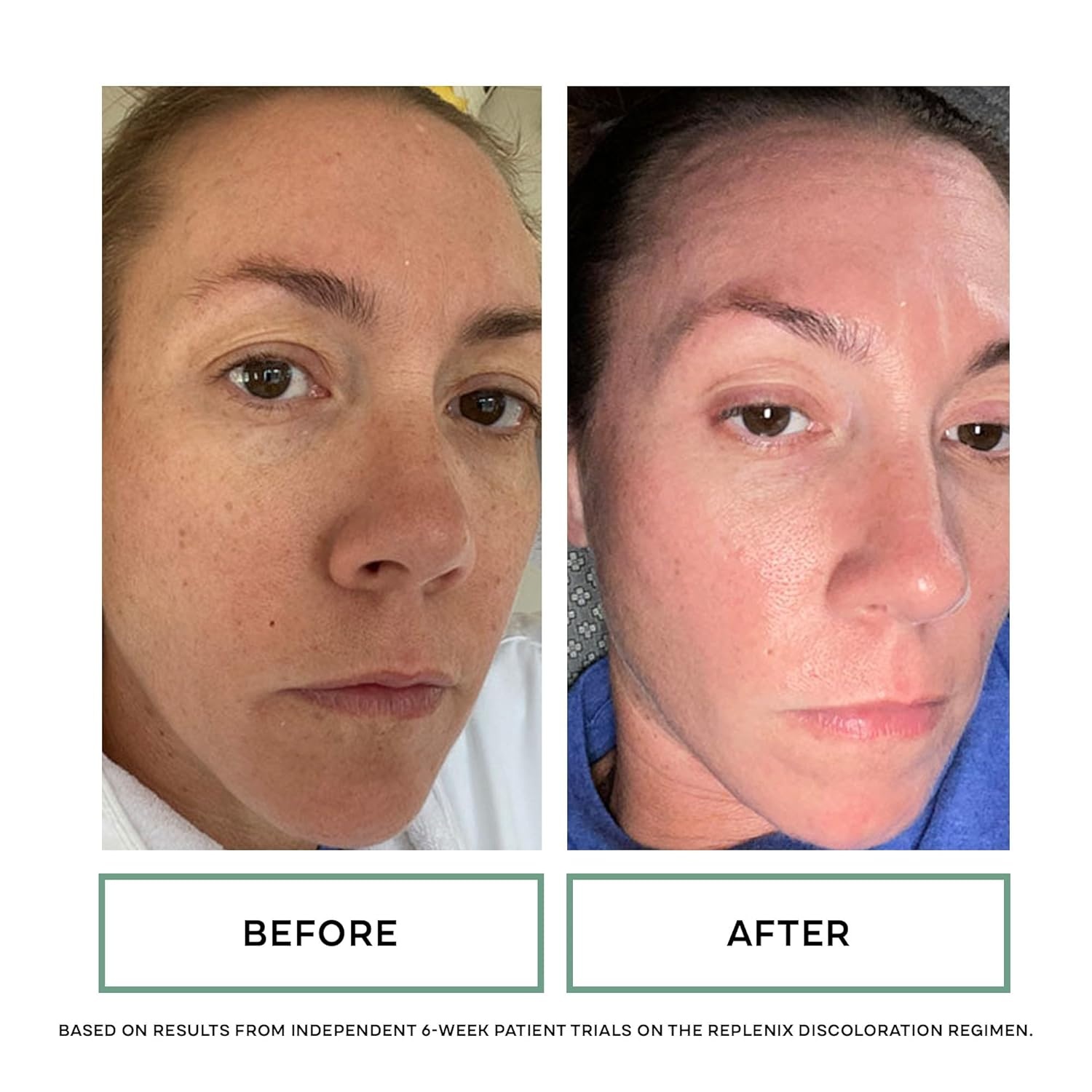 image:imageReplenix Glycolic Acid Resurfacing Skin Peel MedicalGrade Facial Peeling Pads for Discoloration amp Acne 60 ct10 Glycolic Acid