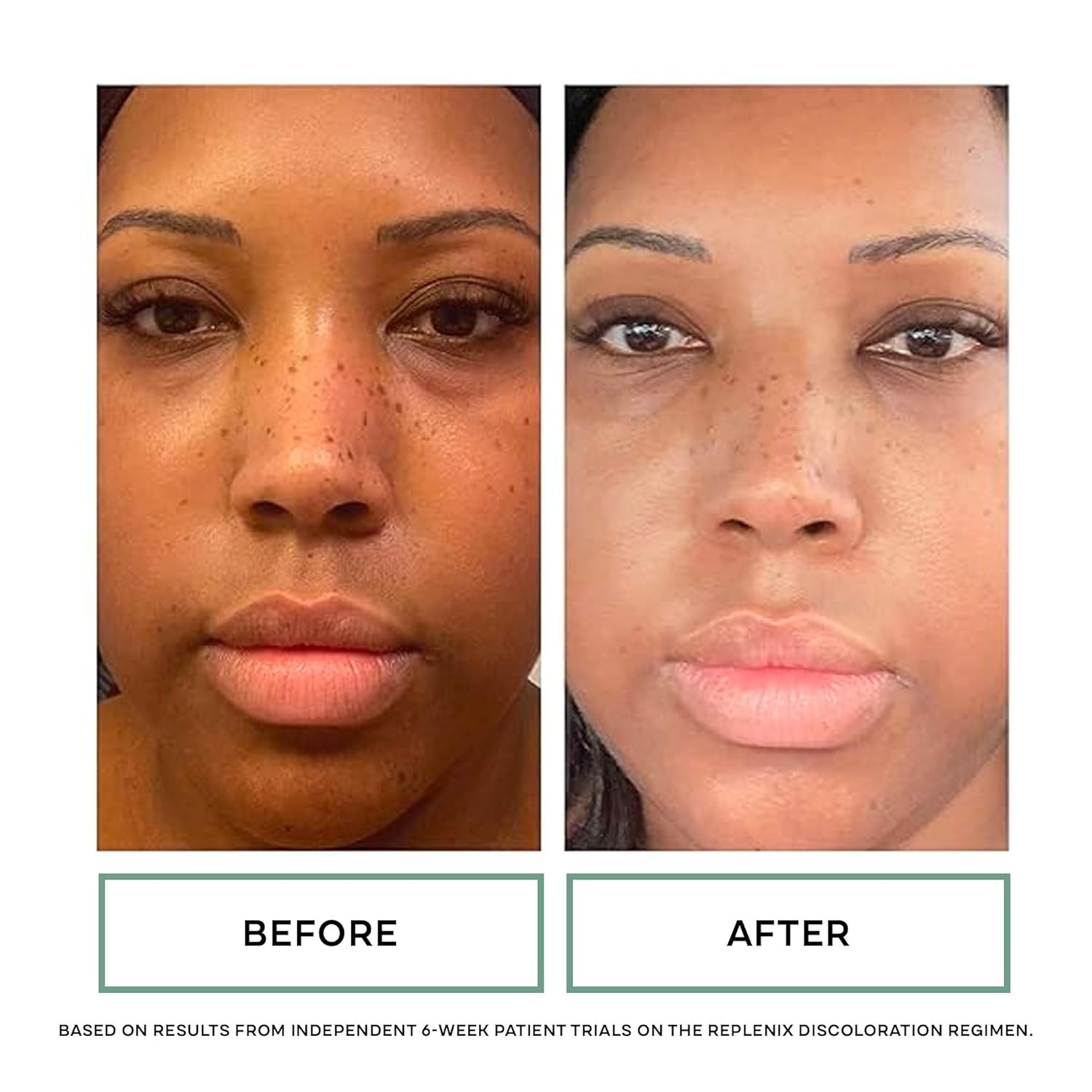 image:imageReplenix Redness Reducing Triple AOX Cream Hydrating MedicalGrade Antioxidant Facial Treatment with Soothing Green Tea for Sensitive Skin 1 fl oz